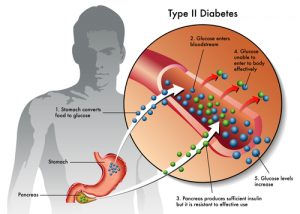 if we don't limit our sugar intake we could develop type 2 diabetes